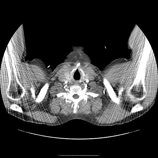 new-page-1-radiology-cornfeld